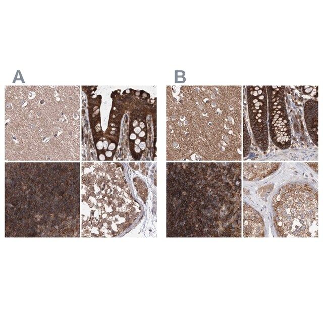 Anti-VPS37B antibody produced in rabbit