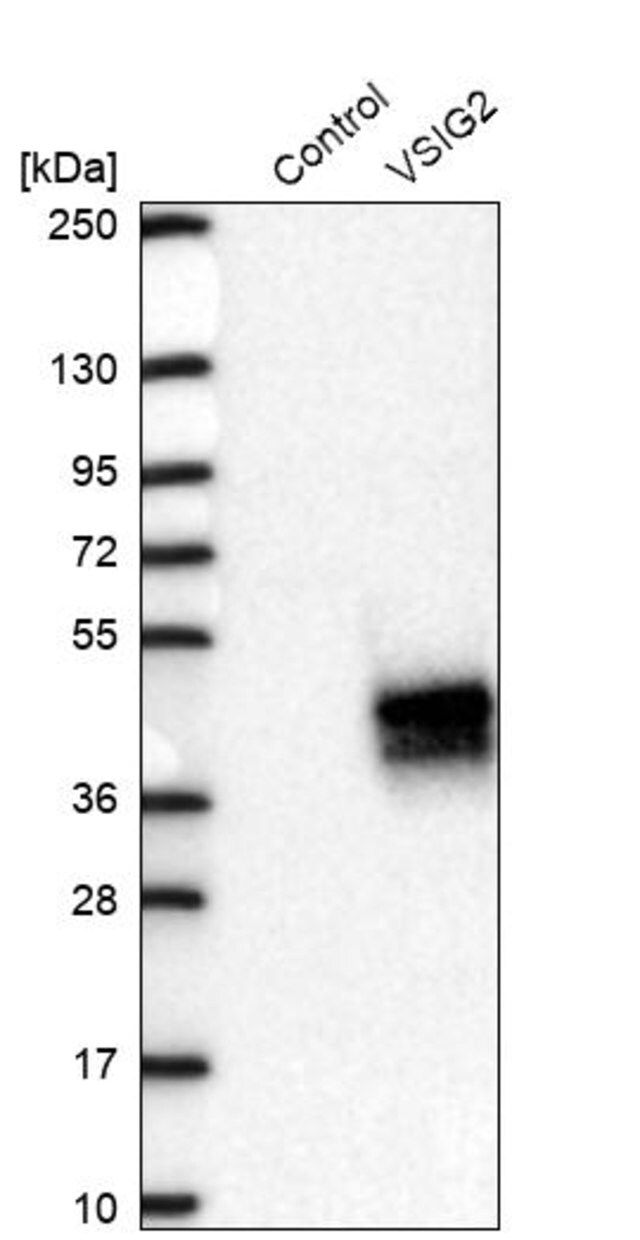 Anti-VSIG2 antibody produced in rabbit