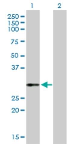 Anti-VWF antibody produced in rabbit