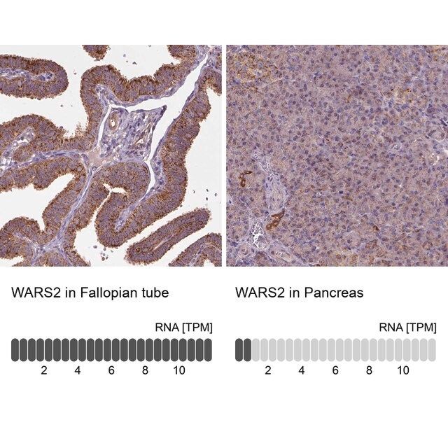 Anti-WARS2 antibody produced in rabbit