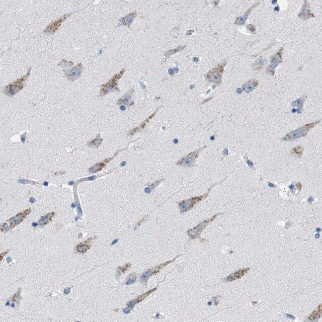Anti-WBSCR17 antibody produced in rabbit