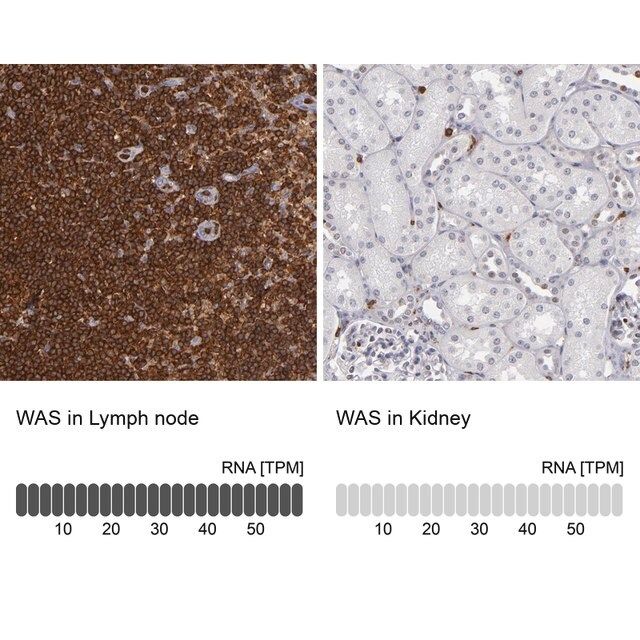 Anti-WAS antibody produced in rabbit