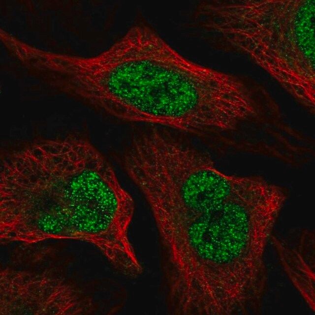 Anti-WAC antibody produced in rabbit