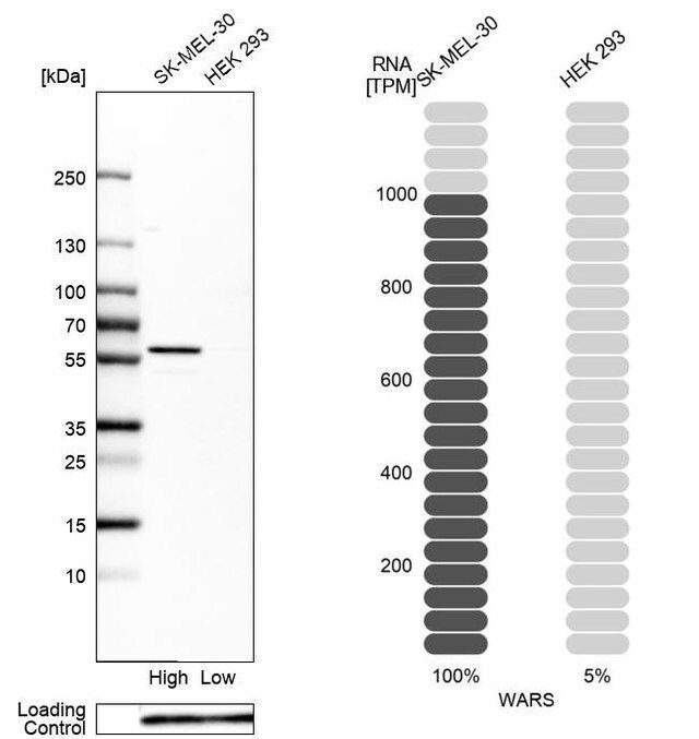 Anti-WARS antibody produced in rabbit