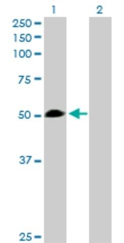 Anti-WARS antibody produced in rabbit
