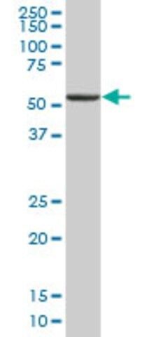 Anti-WARS antibody produced in mouse