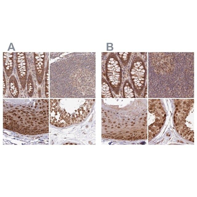Anti-WAPL antibody produced in rabbit
