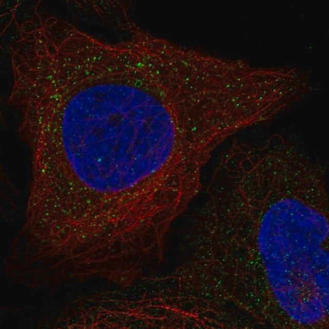Anti-WBSCR28 antibody produced in rabbit