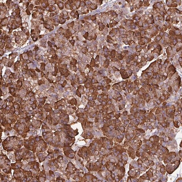 Anti-WBSCR22 antibody produced in rabbit