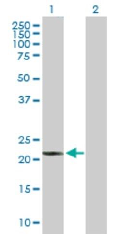 Anti-WARS2 antibody produced in mouse