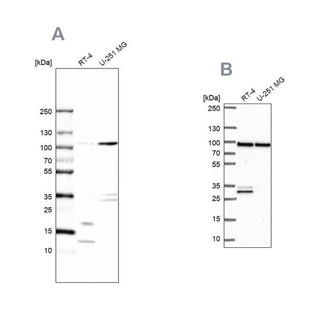 Anti-WDR48 antibody produced in rabbit