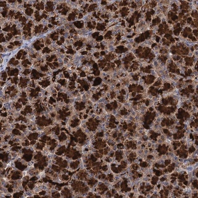 Anti-WDR88 antibody produced in rabbit