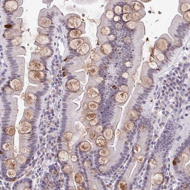 Anti-WDR72 antibody produced in rabbit