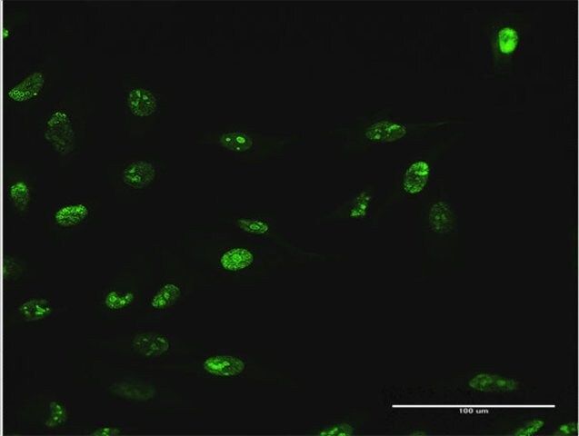 Anti-WDR18 antibody produced in mouse