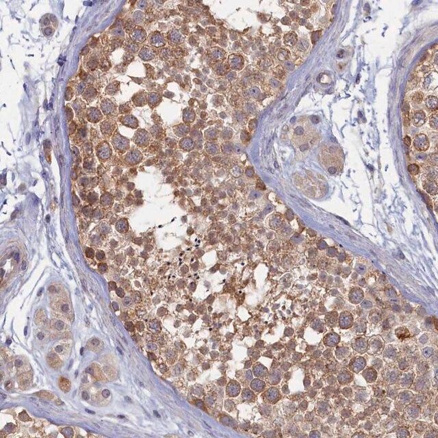 Anti-WDR59 antibody produced in rabbit