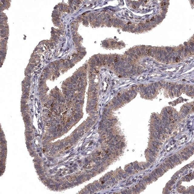 Anti-WDR19 antibody produced in rabbit