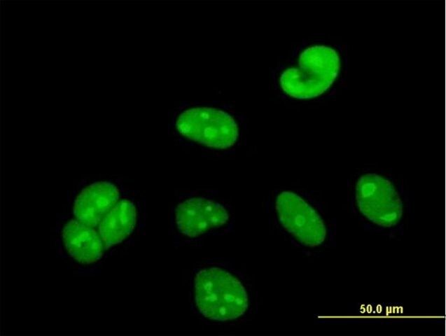 Anti-WBSCR22 antibody produced in mouse