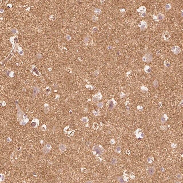 Anti-WDR7 antibody produced in rabbit