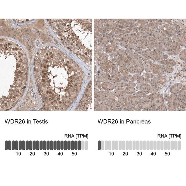 Anti-WDR26 antibody produced in rabbit