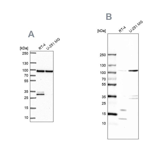 Anti-WDR48 antibody produced in rabbit