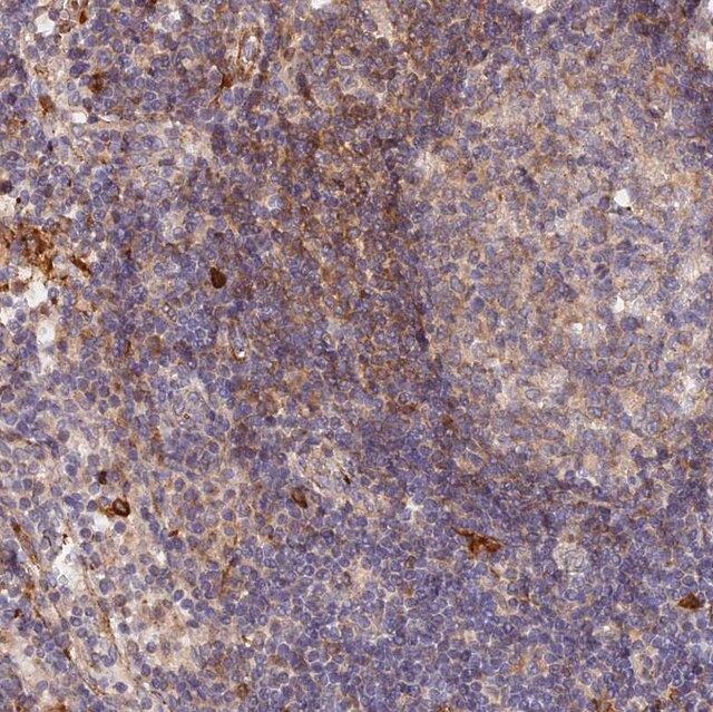 Anti-WDFY4 antibody produced in rabbit
