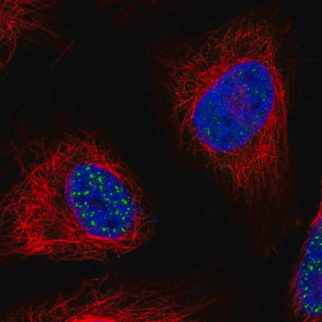 Anti-WDR90 antibody produced in rabbit