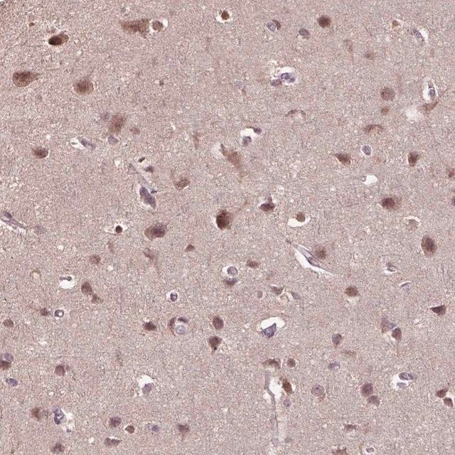 Anti-WDR17 antibody produced in rabbit