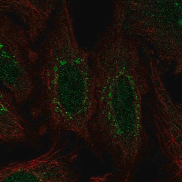 Anti-WDR88 antibody produced in rabbit