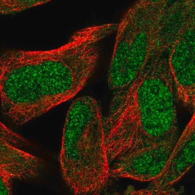 Anti-WDR26 antibody produced in rabbit