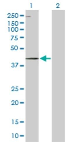 Anti-WDR19 antibody produced in rabbit
