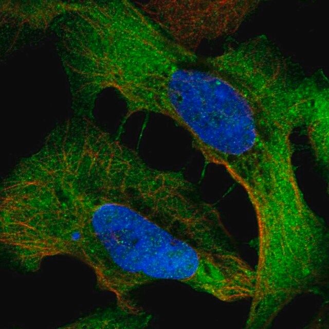 Anti-WDR1 antibody produced in rabbit