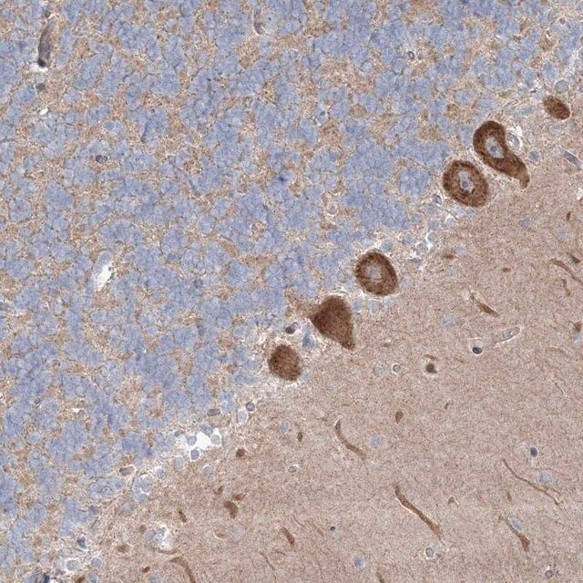 Anti-WDR49 antibody produced in rabbit