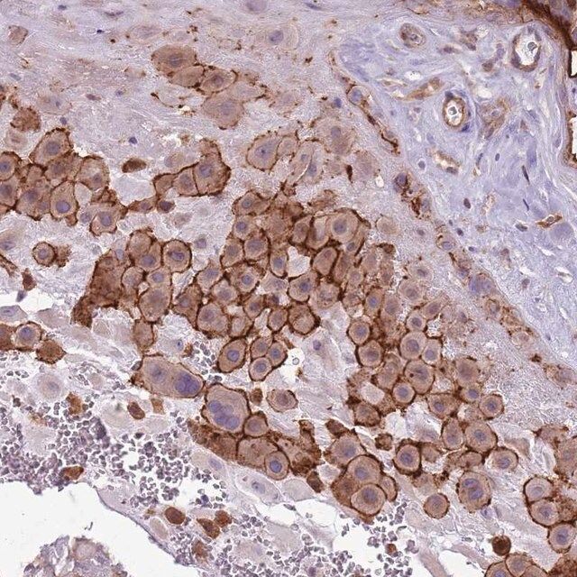 Anti-WDR90 antibody produced in rabbit
