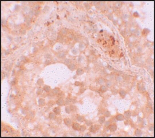 Anti-WDR92 antibody produced in rabbit