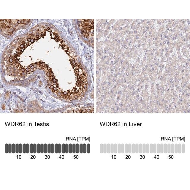 Anti-WDR62 antibody produced in rabbit