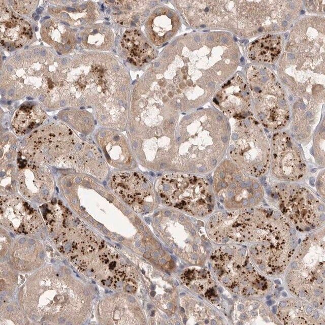 Anti-WDR47 antibody produced in rabbit