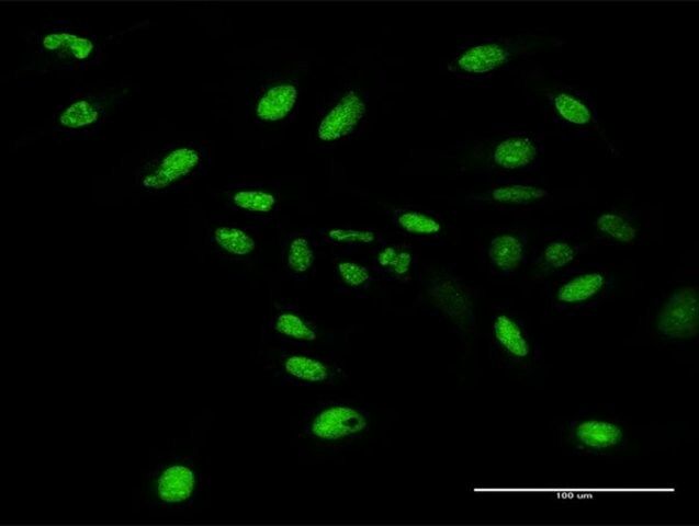 Anti-WDR4 antibody produced in rabbit
