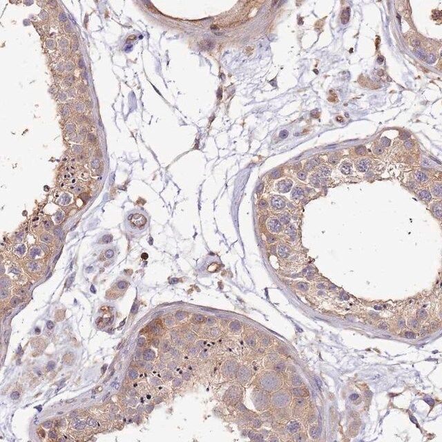 Anti-WDR64 antibody produced in rabbit