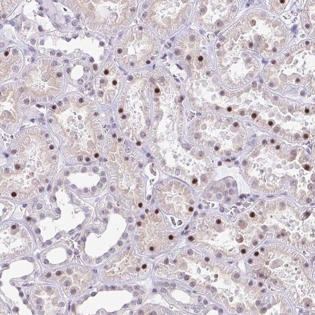 Anti-WDR72 antibody produced in rabbit