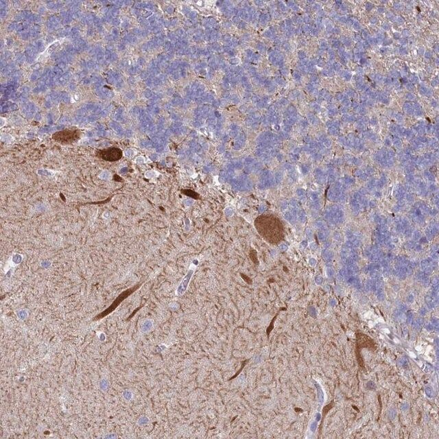 Anti-WDR76 antibody produced in rabbit