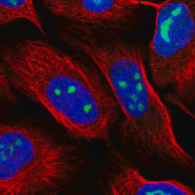 Anti-WDR3 antibody produced in rabbit