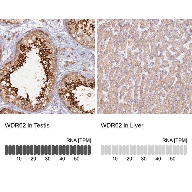 Anti-WDR62 antibody produced in rabbit
