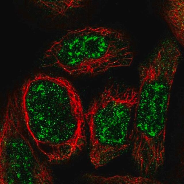 Anti-WDR17 antibody produced in rabbit