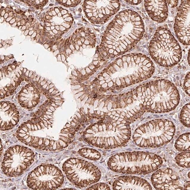 Anti-URM1 antibody produced in rabbit