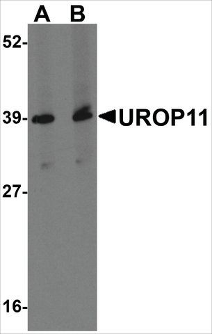 Anti-UROP11 antibody produced in rabbit