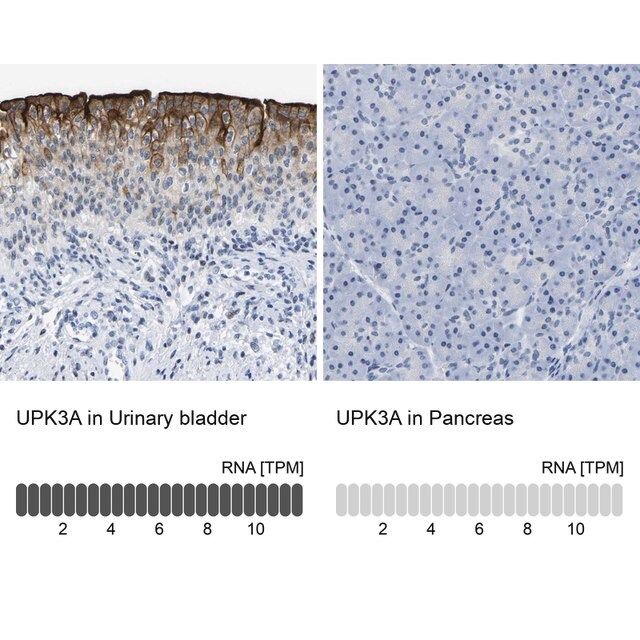 Anti-UPK3A antibody produced in rabbit