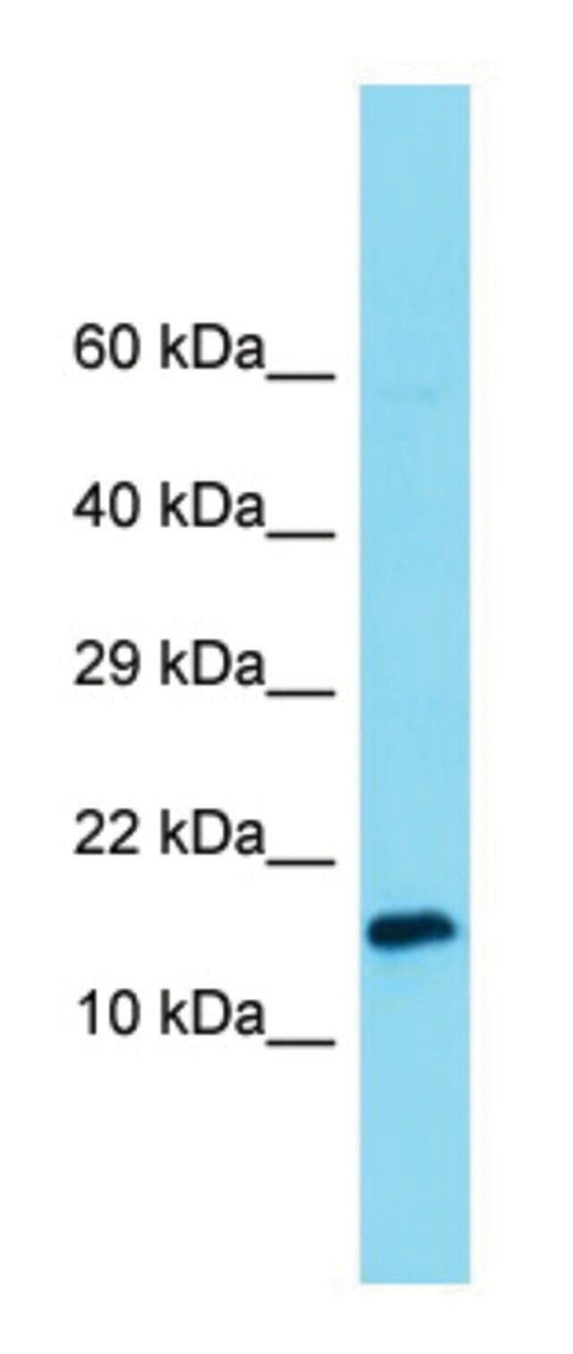 Anti-UQCC2 (C-terminal) antibody produced in rabbit
