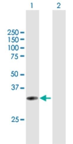 Anti-UPK3B antibody produced in mouse