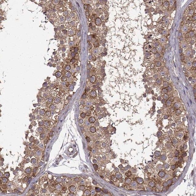 Anti-URI1 antibody produced in rabbit
