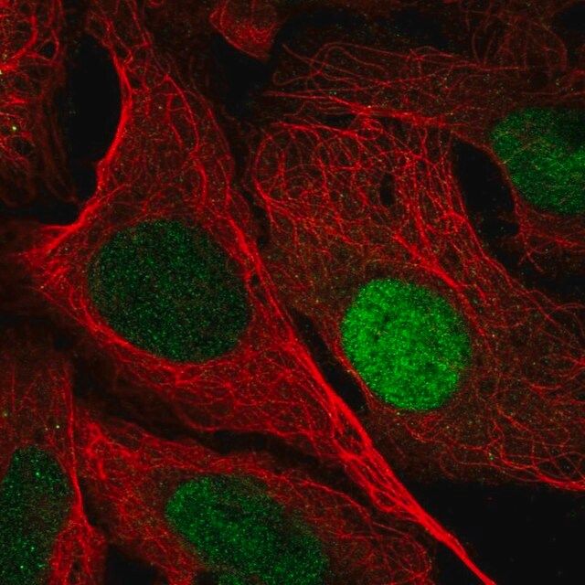 Anti-UPP1 antibody produced in rabbit